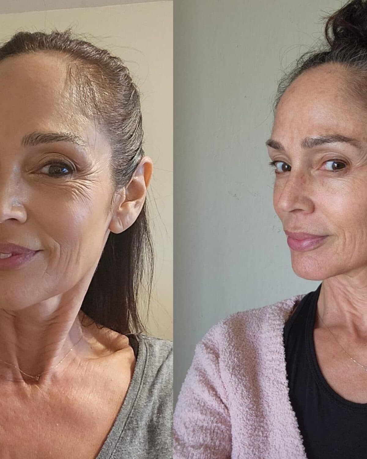 Body contouring at Prophecy Clinic